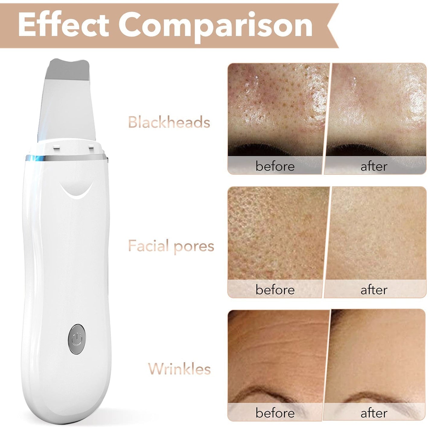 Ultrasonic Skin Scrubber Kit EMS LED Facial MassagerDealsexpress.shopDealsexpress.shopUltrasonic Skin Scrubber Kit EMS LED Facial MassagerUltrasonic Skin Scrubber Blackhead Remove Deep Face Cleaning Machine Facial Whitening Lifting Dirt Wrinkles Spots ReduceFeatures:This item combines two skin care tre